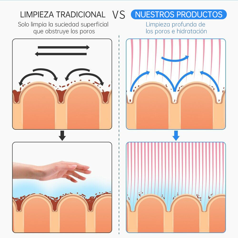 Máquina Hidrofacial 6 en 1 Limpieza Profunda, Microdermoabrasión, Radiofrecuencia, Ultrasonido, Pulverizador, Terapia Fría – Profesional para Spa y Estética