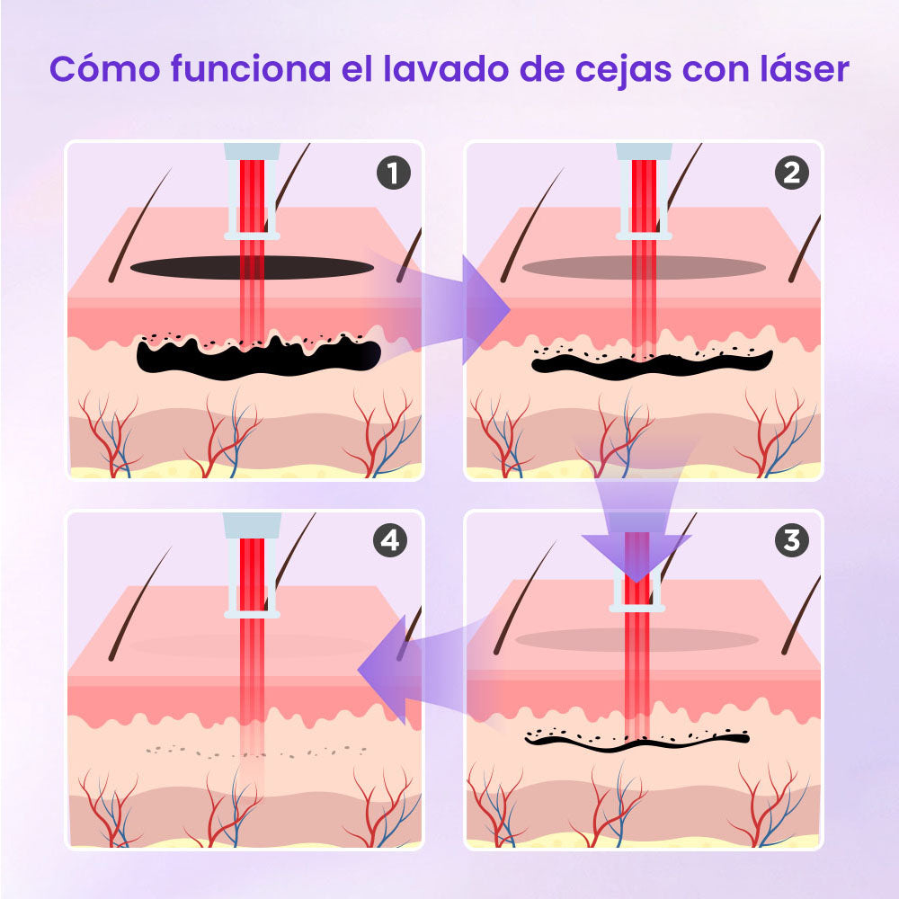 Equipo Profesional 2 en 1 para Depilación Definitiva, Blanqueamiento, Rejuvenecimiento Facial, Eliminación de Tatuajes, Manchas, Lunares y Acné