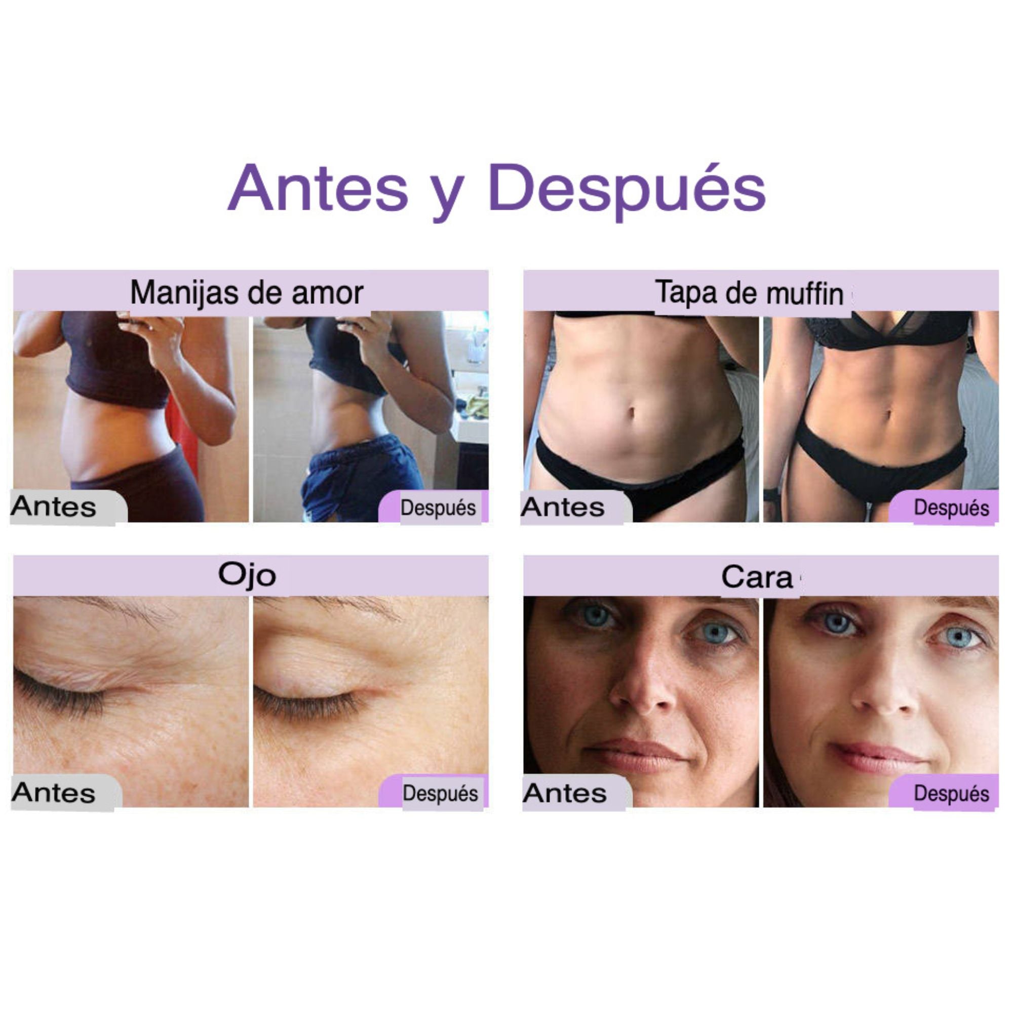 Multifuncional 9 en 1 Pro 2.5 para Spa y Estética – Cavitación 40K, Radiofrecuencia, Vacío, Láser Lipolítico y Rejuvenecimiento Facial