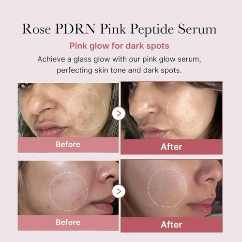 Serum Medicube Pdrn Pink Niacinamida Corea Premium Pro 30ml