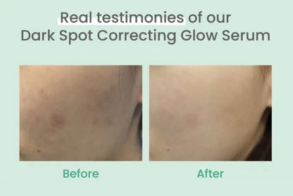 AXIS-Y Dark Spot Correcting Glow Serum 50 ml