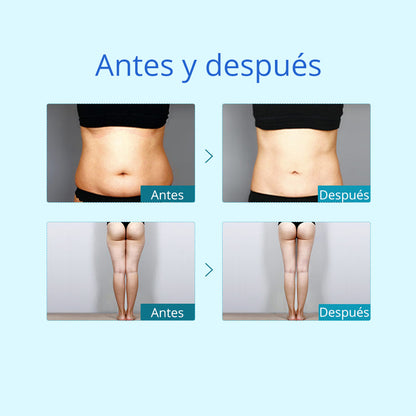 Criolipólisis Profesional 2 Cabezales – Reducción de Grasa, Modelado y Definición Corporal