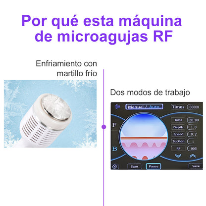 Microagujas de Oro con Radiofrecuencia Fraccionada – Lifting 4D y Regeneración Avanzada