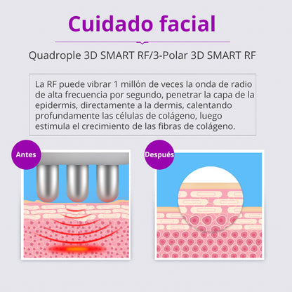 Multifunconal 6 en 1 de Cavitación Ultrasónica 40K, Radiofrecuencia, Vacum y Lipolaser de Alta Precisión