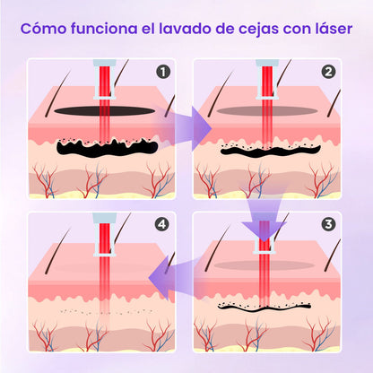 Equipo Profesional 2 en 1 para Depilación Definitiva, Blanqueamiento, Rejuvenecimiento Facial, Eliminación de Tatuajes, Manchas, Lunares y Acné